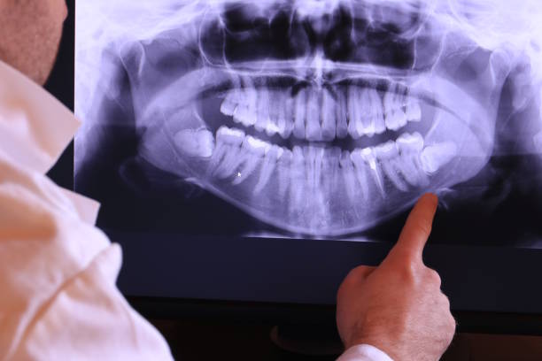 Best Emergency TMJ Treatment in Marion, MS