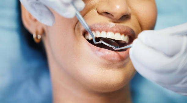 Best Urgent Care for Lost Fillings or Crowns in Marion, MS
