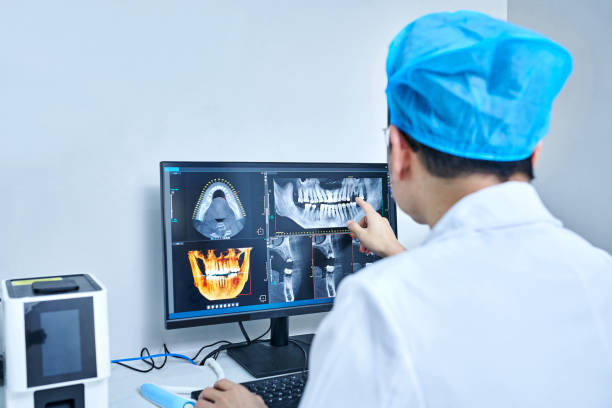 Best Emergency Treatment for Dental Infections or Abscesses in Marion, MS
